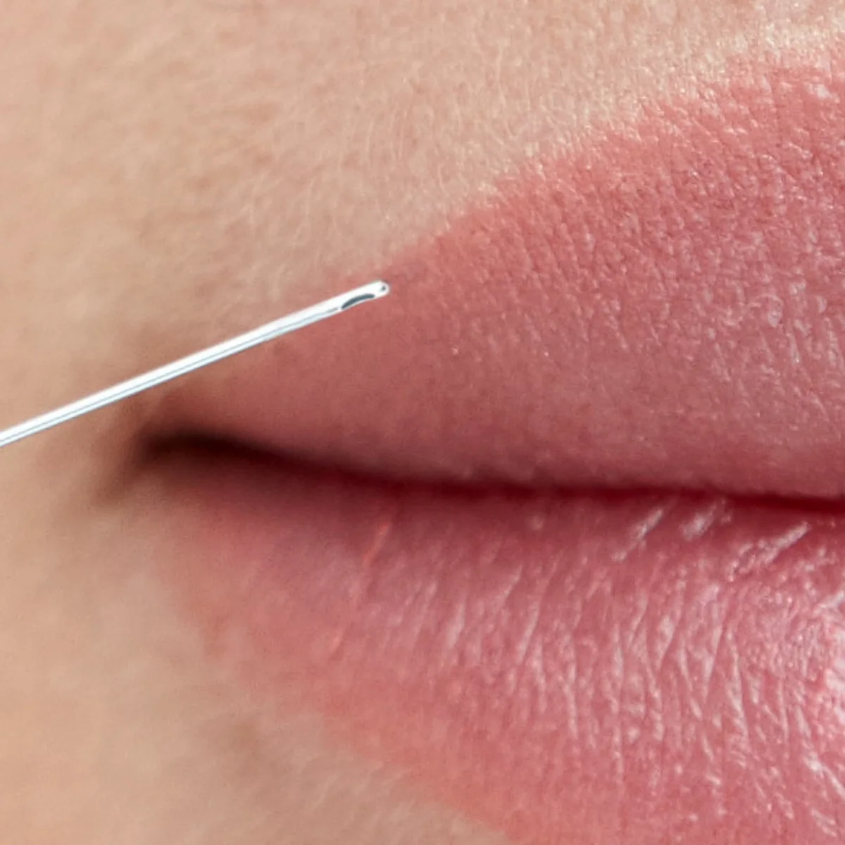 fill·k microcânula — aplicação em lábios